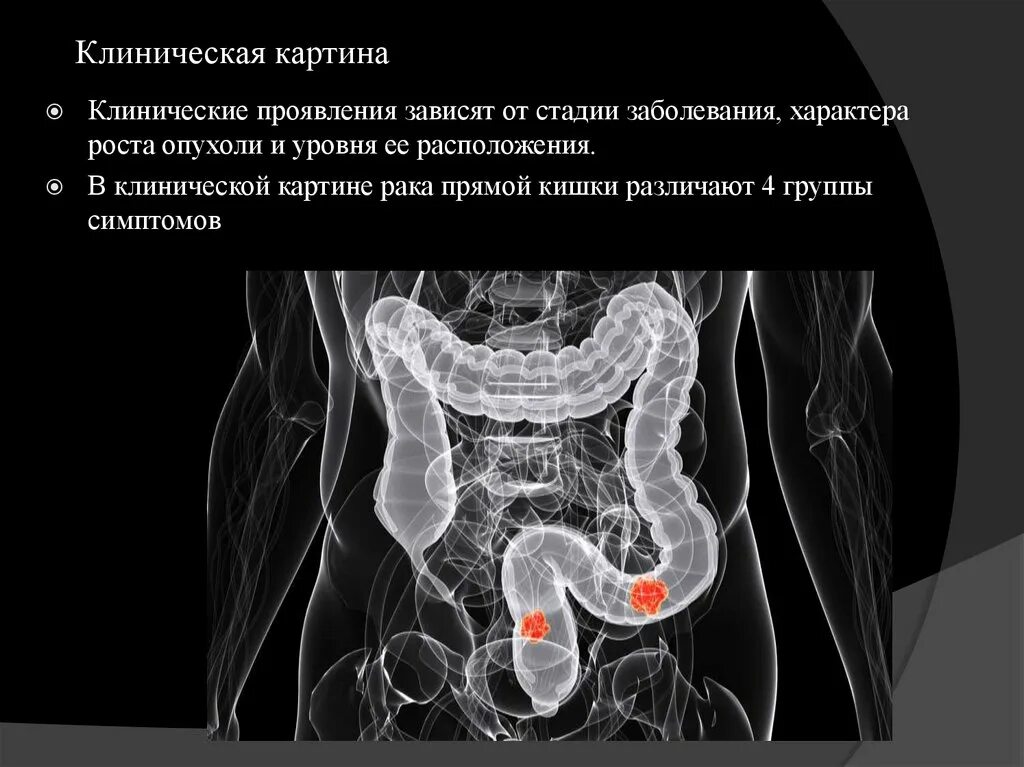 Хирург прямая кишка
