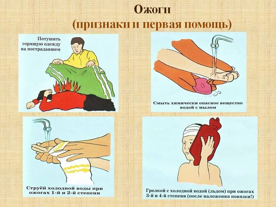 Ожоги обж 8 класс. Ожоги признаки и первая помощь. Признаки и первая помощь при ожогах.