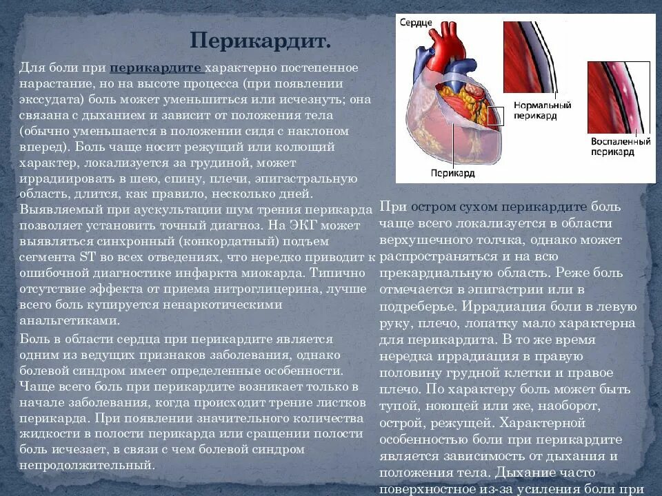 Боли при заболеваниях легких. Характерные боли сердца. Острый перикардит боль. Боль при перикардите. Боли при заболеваниях сердца.