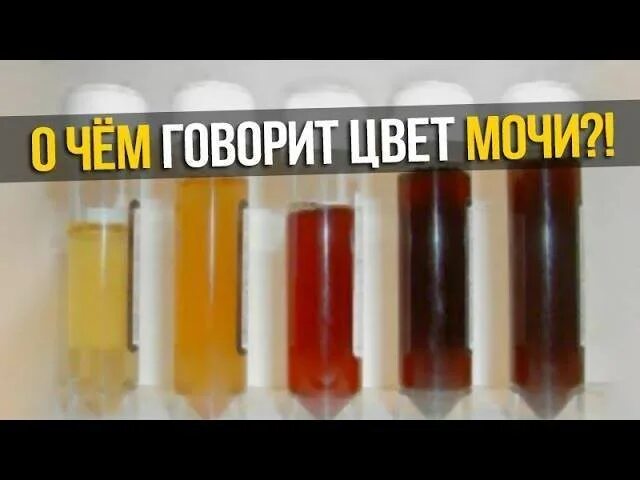 Моча темного цвета. Цвет мочи. Желто коричневый цвет мочи. Коричневый цвет мочи. Почему у мужчины коричневая моча