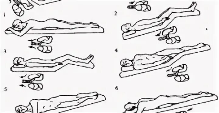 Как делать массаж отхождение мокроты. Постуральный дренаж техника. Постуральный массаж для отхождения мокроты детям. Постуральный дренаж положение Квинке. Постуральный дренаж при пневмонии у детей.