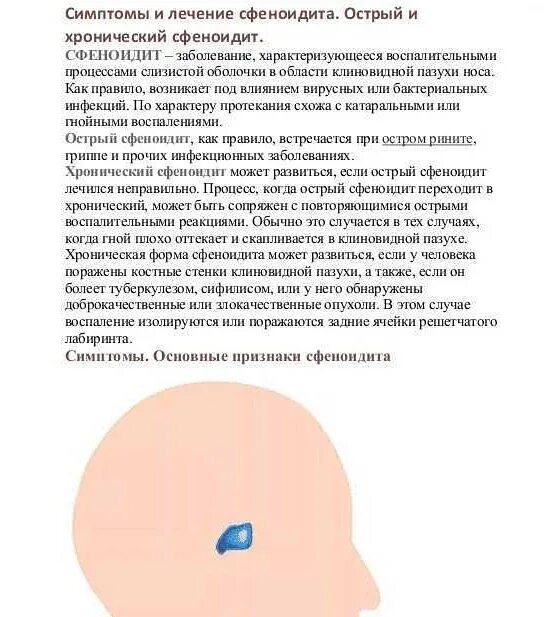 Сфеноидит симптомы. Сфеноидит симптомы