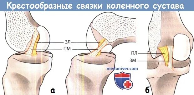 Повреждение связок коленного сустава код 10. Повреждение связок коленного сустава код 10