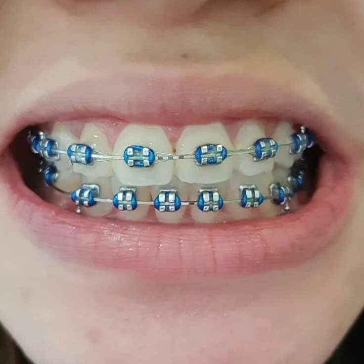Brackets 2025