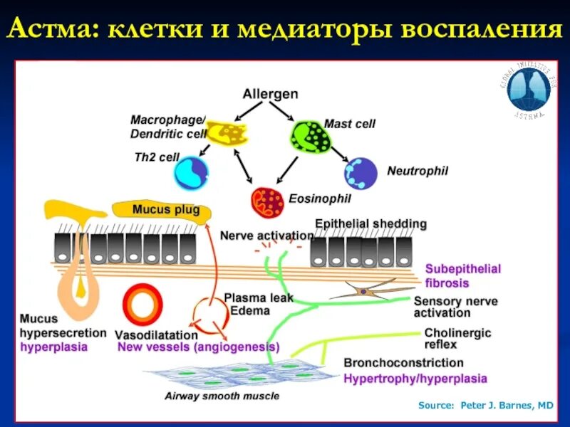 Клеточные медиаторы воспаления. Медиаторы воспаления бронхиальной астмы. Бронхиальная астма клетки воспаления. Медиаторы воспаления при бронхиальной астме. Механизм развития бронхиальной астмы.