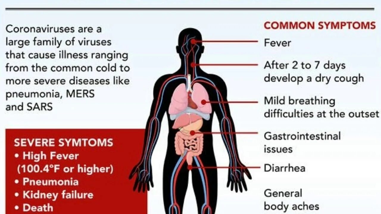 Коронавирус декабрь. What is coronavirus. Coronavirus Symptoms. Вирус уороно коронавирус. Как выглядит коронавирус.