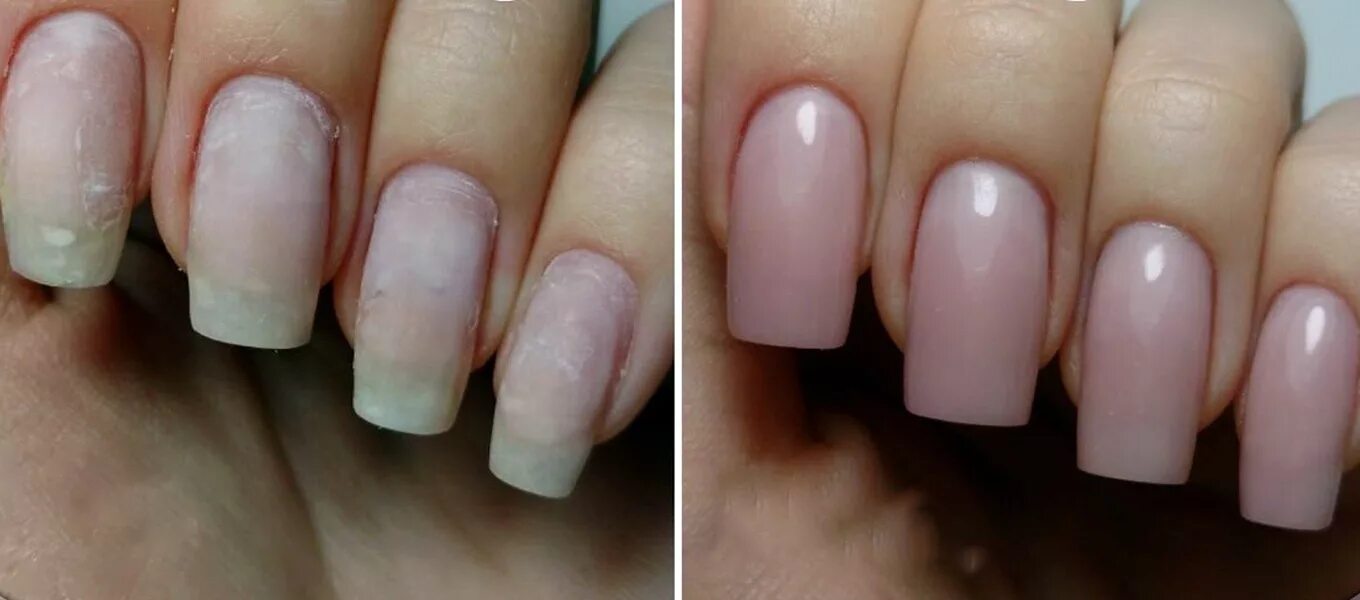 Укрепление натуральных ногтей. Маникюр до и после. Ногти до и после. Маникюр гель лак до и после. Чем покрыть ногти после геля