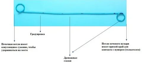 Стент боль при мочеиспускании