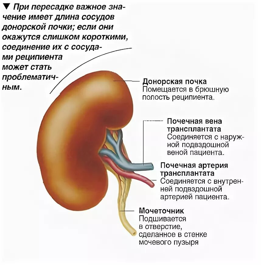 Какую почку пересаживают