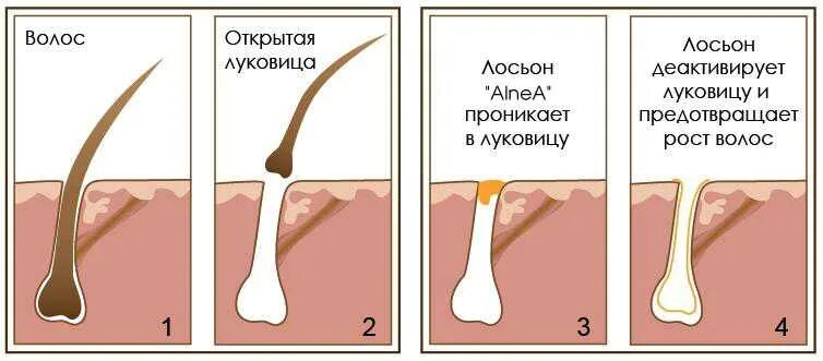 Растут корни волос. Волосяная луковица. Против роста волос. Волос с волосяной луковицей. Выдергивание волоса с луковицей.