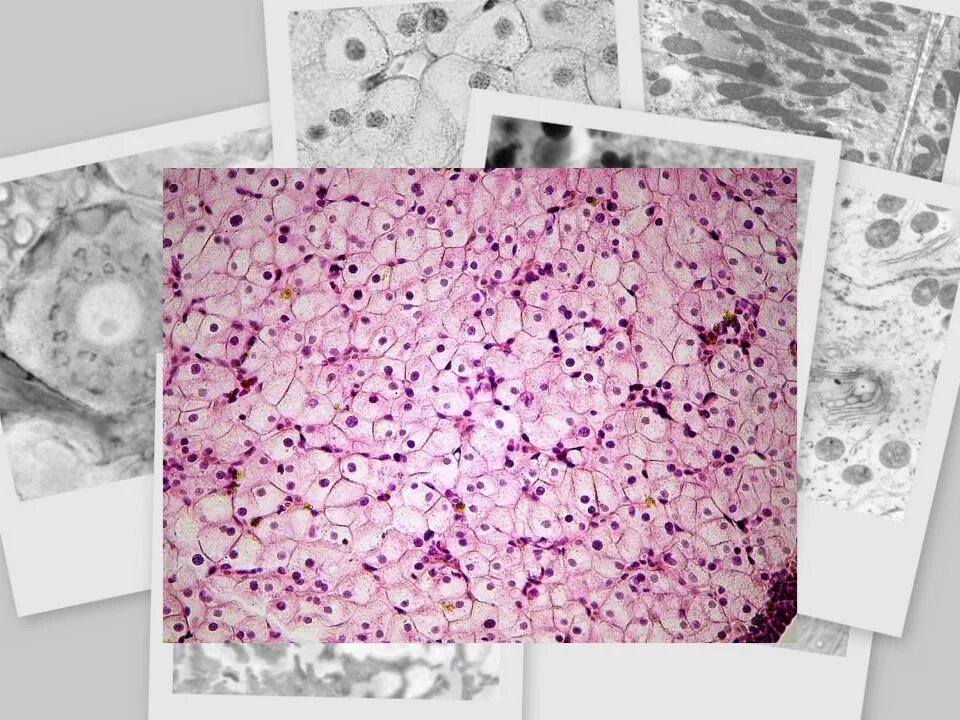 Митохондрии в клетках печени. Общая морфология клетки печени аксолотля. Препарат общая морфология клетки печень аксолотля. Клетки печени гистология. Общая морфология клетки гистология препарат.