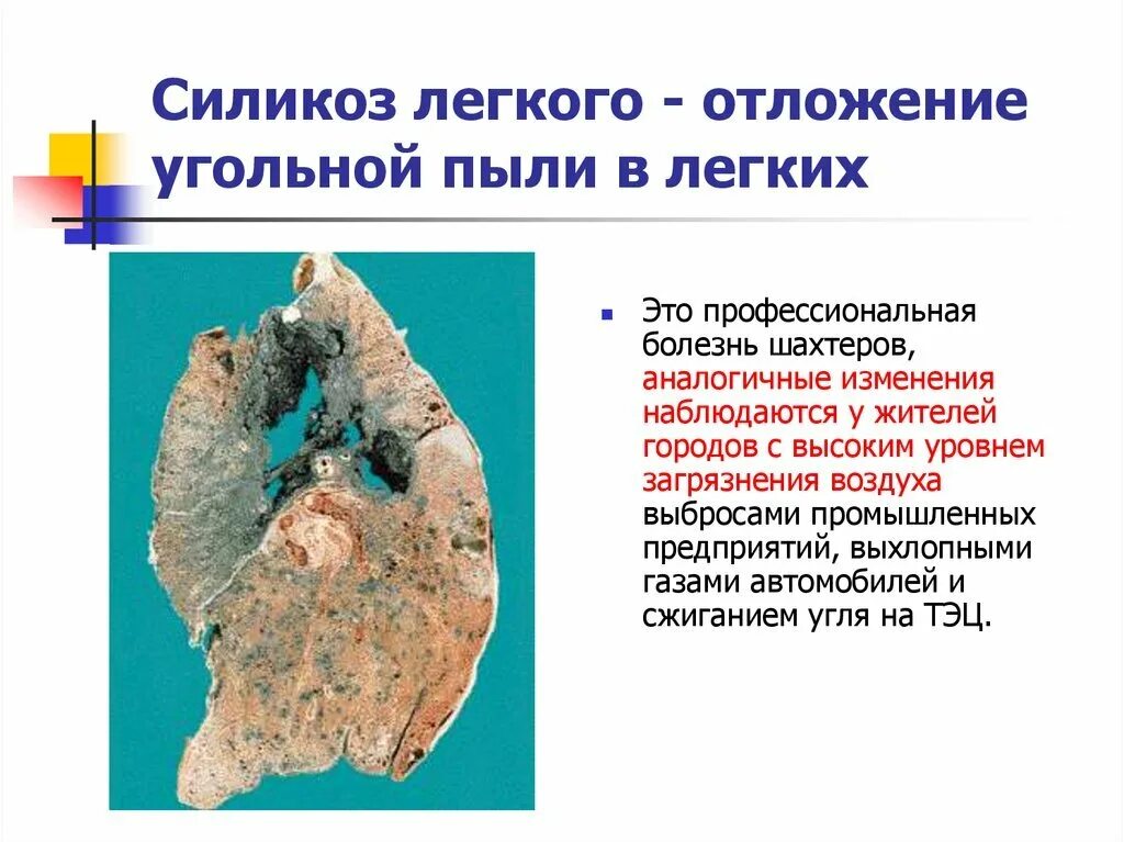 Класс угольной пыли