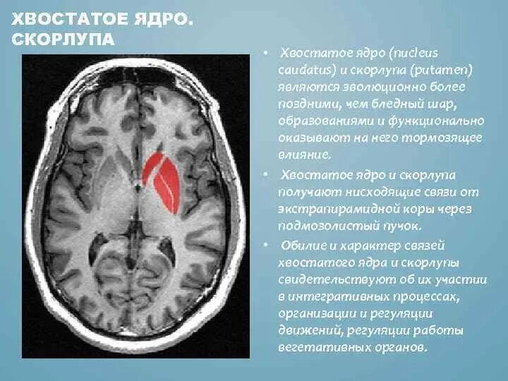 Хвостатое ядро мозга. Хвостатое ядро головного мозга. Скорлупа базальные ядра. Хвостатое ядро и скорлупа. Головка хвостатого ядра.