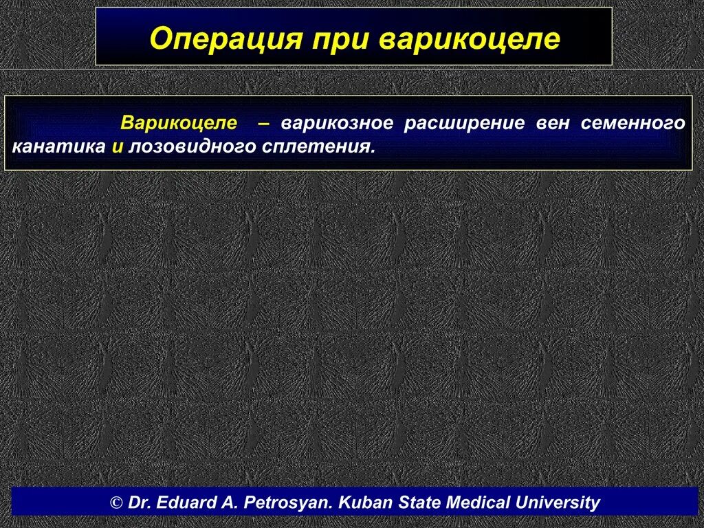 Расширение вен канатика. Варикозное расширение вен семенного канатика. Варикозное расширение вен яичка операция. Варикоцеле – расширение вен семенного канатика. Операция Лопаткина варикоцеле.