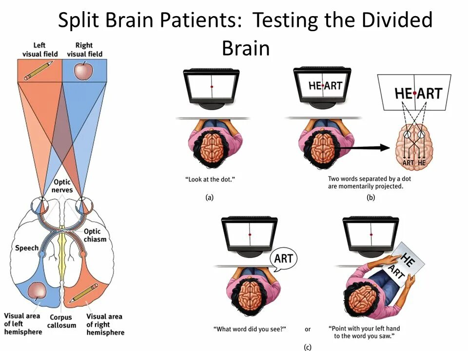 Split Brain problem. Газзанига расщепленный мозг.