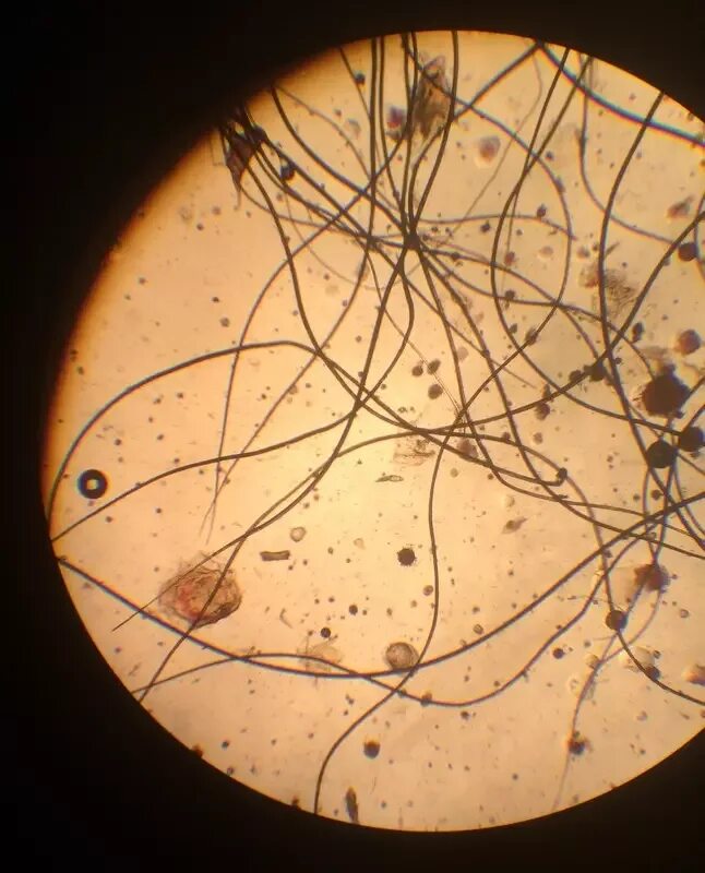 Собака под микроскопом. Демодекс канис в микроскопе. Собачий и кошачий власоед. Собака с языком. Саркоптоз возбудитель.