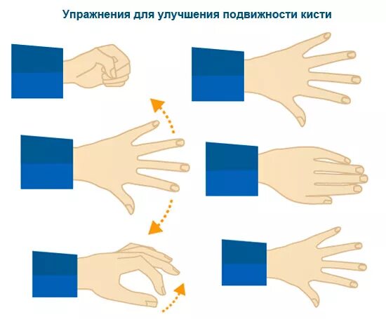 Инсульт гимнастика руки. Гимнастика для мелкой моторики рук после инсульта. Упражнения для моторики рук после инсульта. Упражнения реабилитации после инсульта для кисти руки. Комплекс упражнений для рук после инсульта.