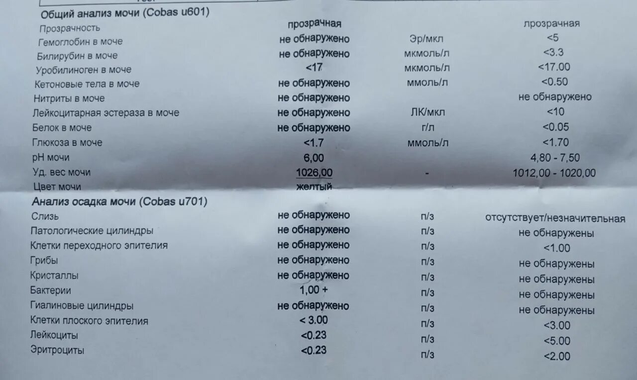 Тетрагидроканнабинол 50 НГ/мл. Осадки в моче у ребенка. Осадок в моче у ребенка 3 года. Гашиш в моче.