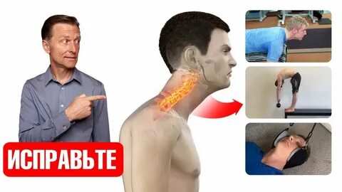 Искривление шейного отдела позвоночника