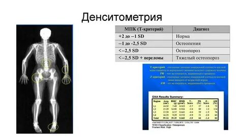 Исследование плотности