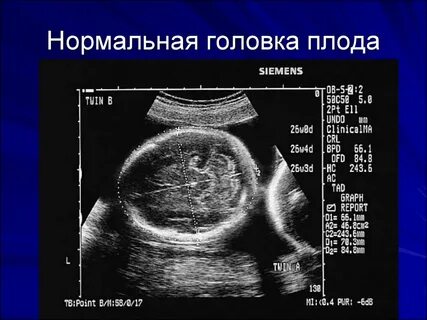 Узи размер головы