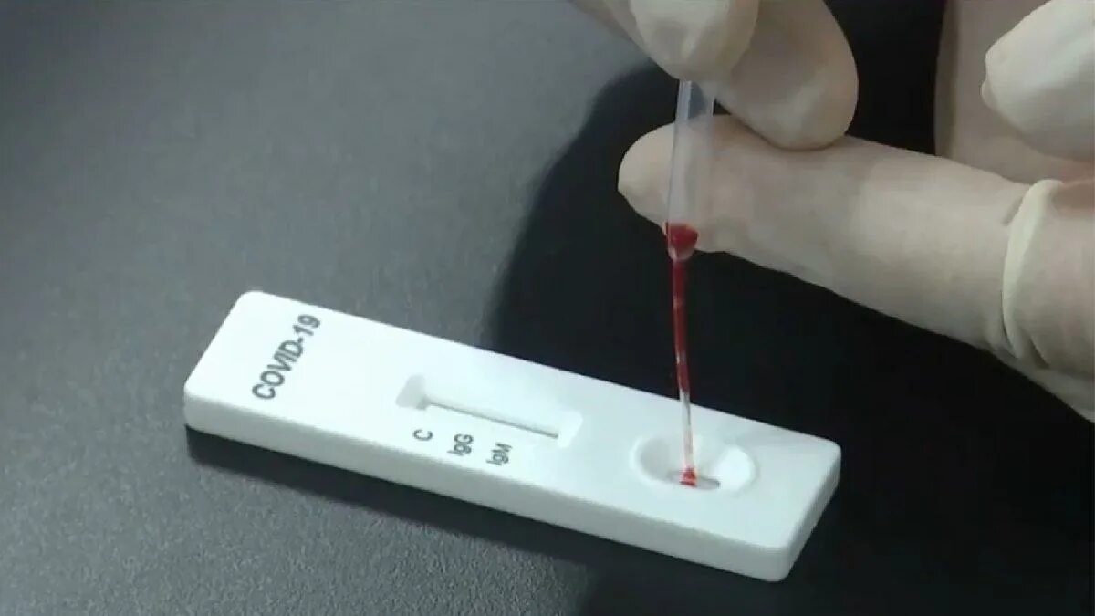 Экспресс тест как берут. Corona test. экспресс-тест на ковид. тест на корону. тест на корону положительный.