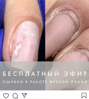 Пропили ногтей