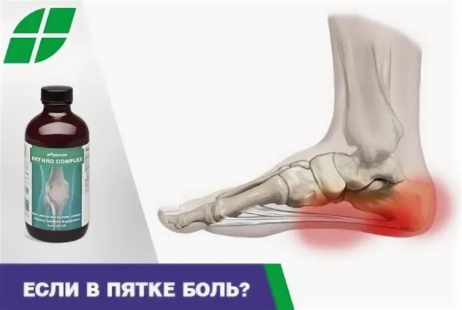 Таблетки от боли в пятке. Таблетки от боли в пятке. Эффективное обезболивающее средство при болях в уколах. Пяткашпор крем усиленный. Таблетки от боли в пятке при наступании.
