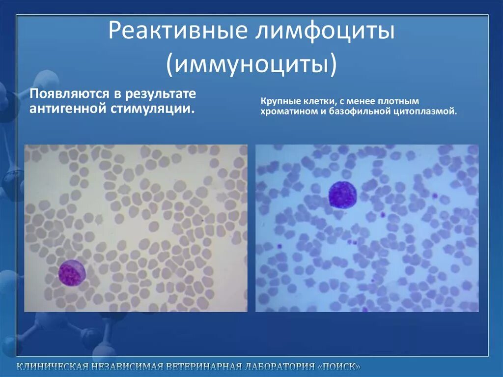 Клетки с признаками реактивных изменений