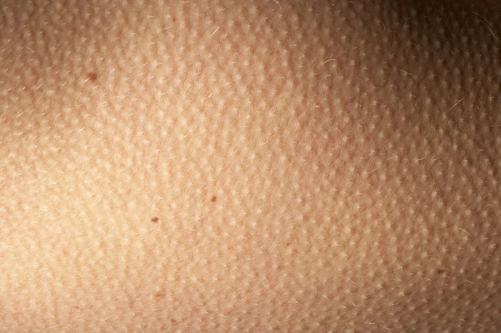 Причины ползания мурашек