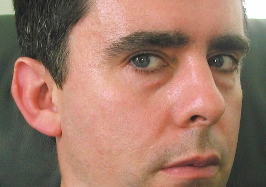 Появились мешки под глазами у мужчин