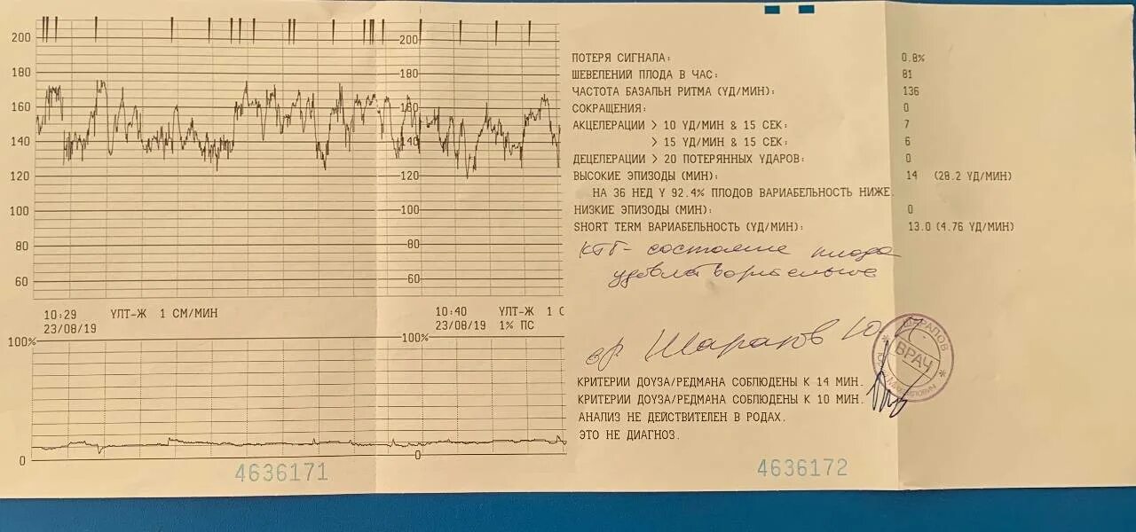 КТГ на 33 неделе беременности. КТГ на 31 неделе беременности. КТГ плода норма 34. КТГ на 36 неделе беременности. Шевеление плода 32 неделя