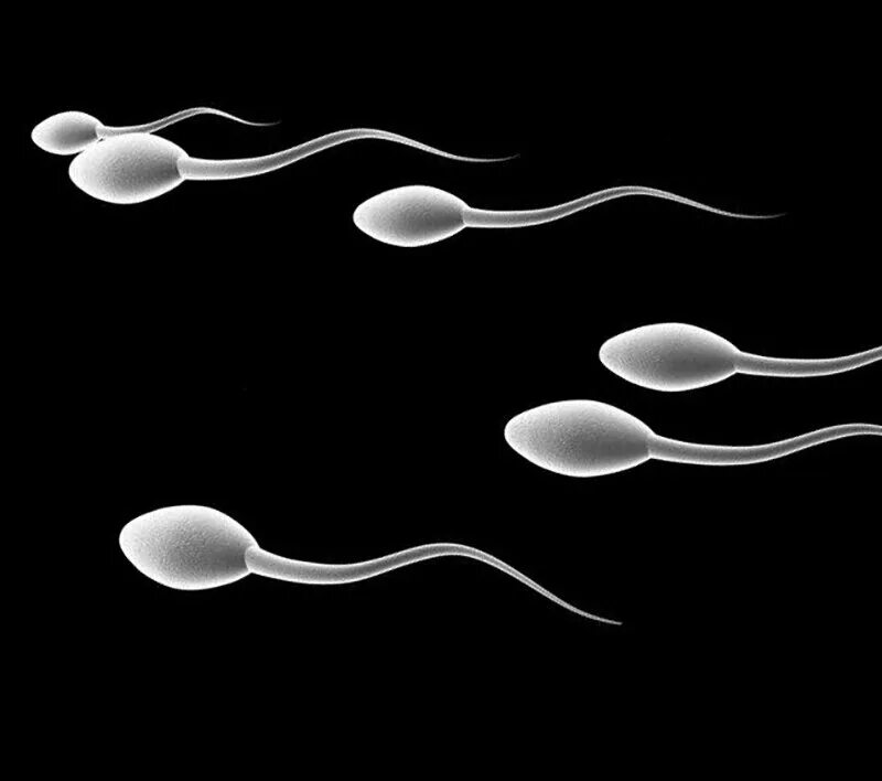 Спермии а и б. Анализ сперматозоидов норма. Оплодотворение анатомия. Сперматозоид иллюстрация. Сперматозоид мультяшный.