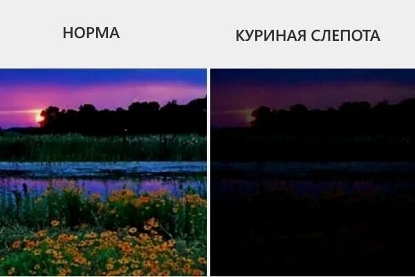 Почему плохо вижу в темноте