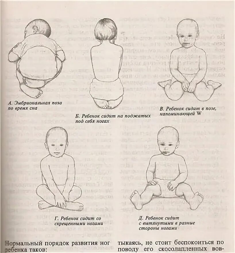 Во сколько малыши сидят. Этапы ползания ребенка. Во сколько месяцев ребёнок должен сидеть самостоятельно. В каком возрасте дети начинают сидеть самостоятельно. Как понять чттреюенок сидит.