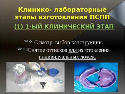 Этапы изготовления съемного пластиночного протеза