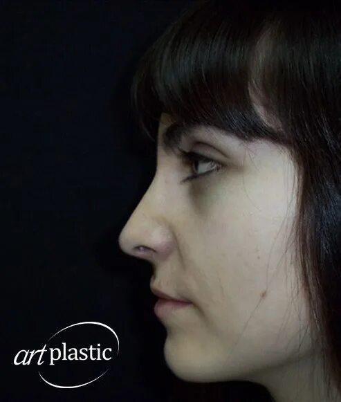 Длинный нос у девушки. Женщина с горбатым носом. Армянский нос. Фрунзик мкртчян mimino. Армянский нос с горбинкой.