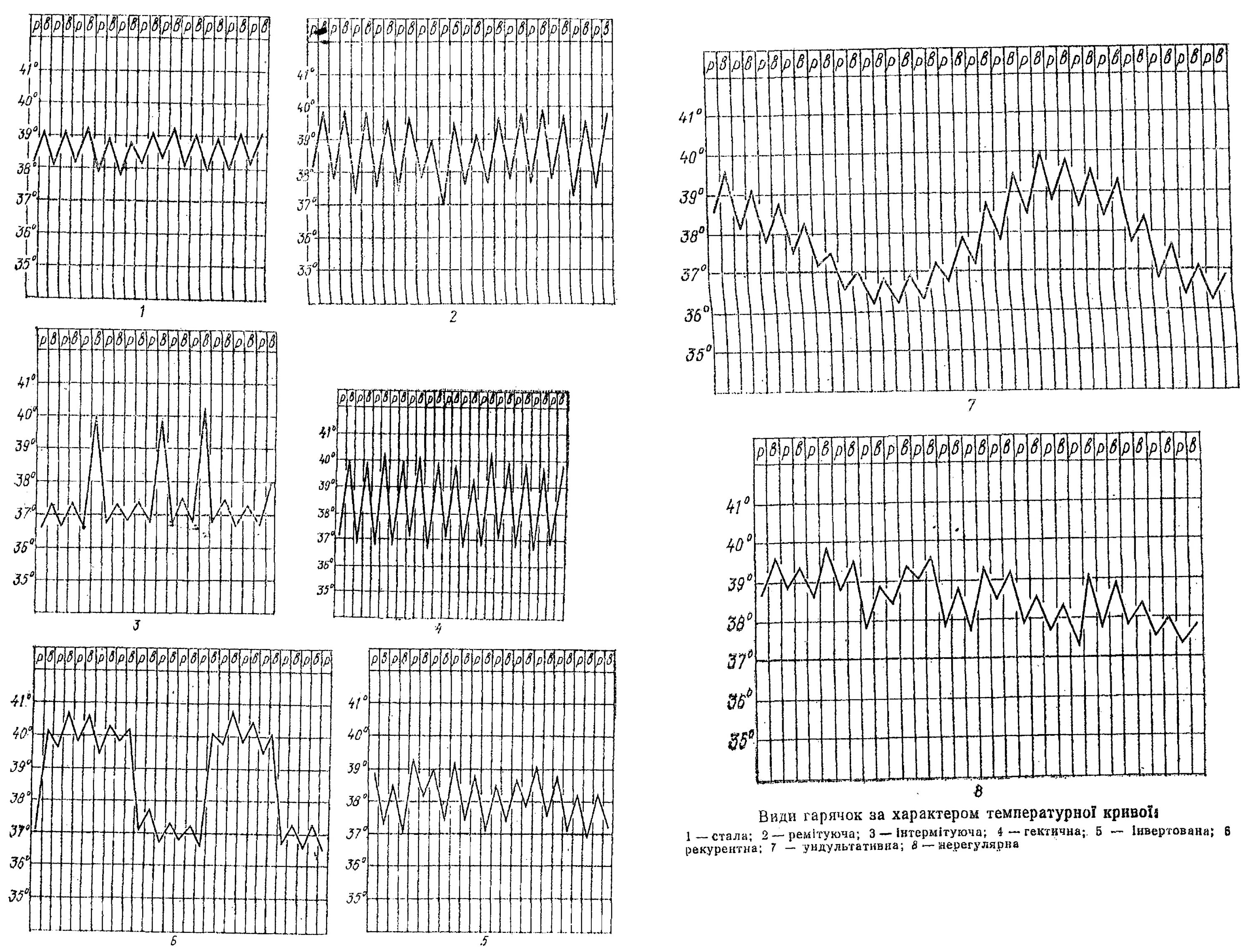 Температурный лист графическим. Лихорадка температурные кривые. Типы лихорадок на температурном листе. Типы лихорадок температурные кривые. Типы температурных кривых схема.