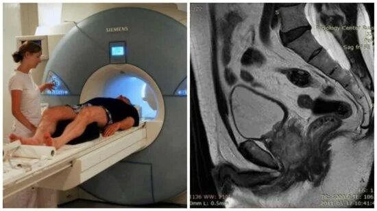 Чем отличается узи от мрт. Мрт малого таза Сергея Березина. Мрт ОМТ С контрастированием. Томография (мрт, кт, ПЭТ) мозга. Мультипараметрическая мрт.