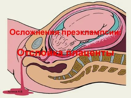 Раствор плаценты