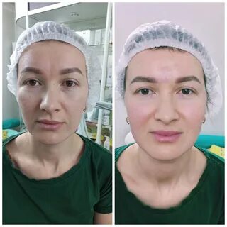 Жидкие нити отзывы