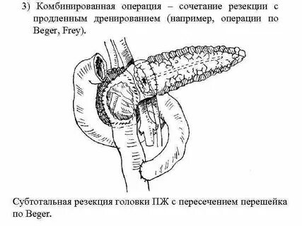 Операция орех