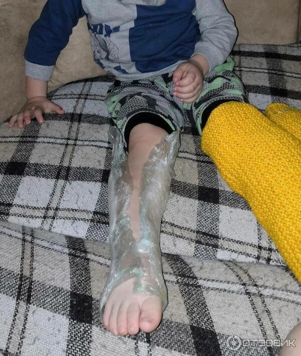 Сапожки озокерит парафин. Парафиновые сапожки для детей. Озокерит физиотерапия. Парафиновые сапожки для детей. Парафино озокеритовые сапожки для детей.