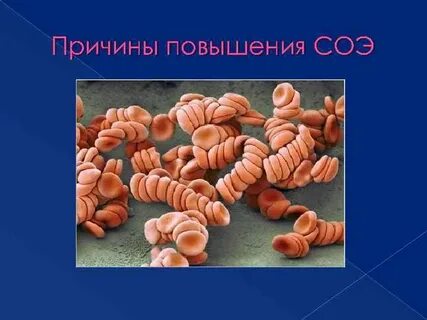 Синдром ускоренного соэ код по мкб 10