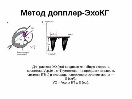 Доплер эхокг