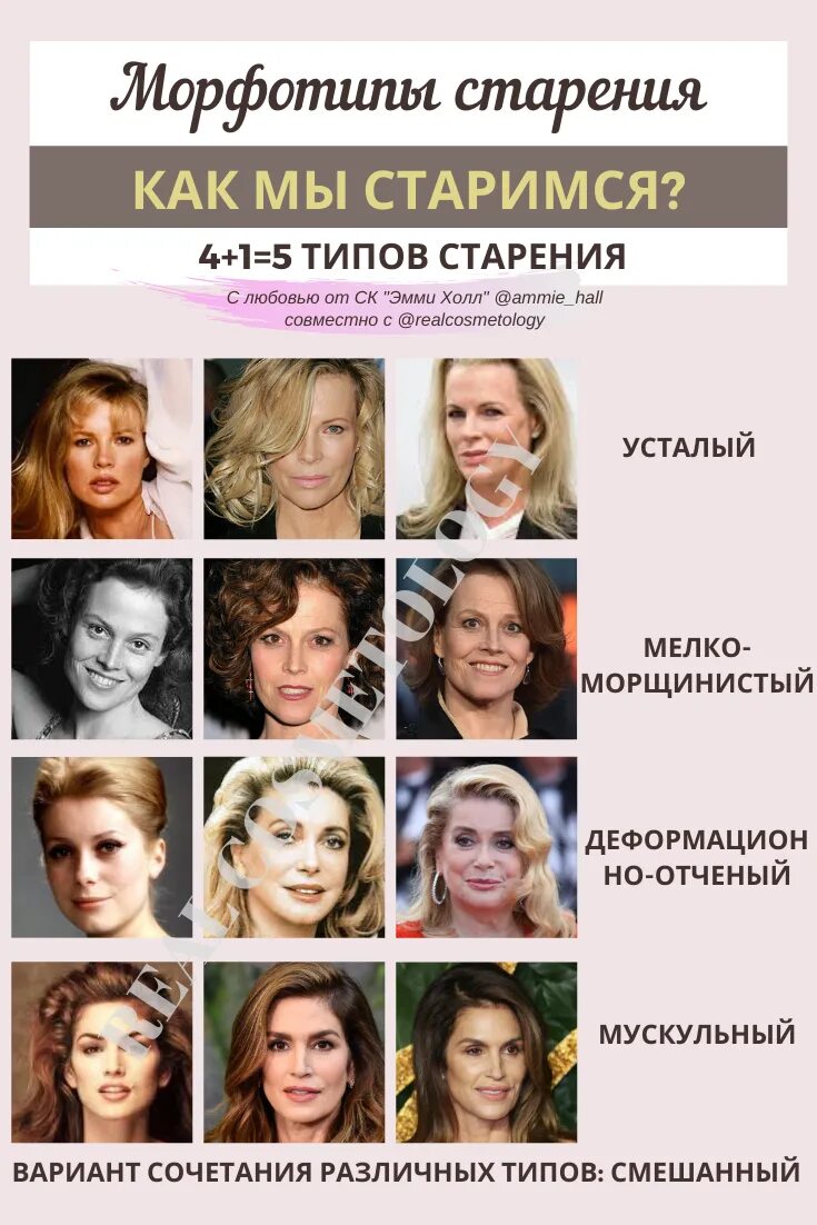 Одри хепберн тип старения. Типы старения лица. Смешанный тип старения кожи. Причины старения кожи. Деформационно отечный тип старения лица.