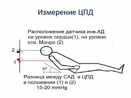 Церебральное перфузионное давление