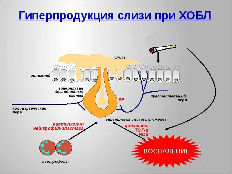 Гиперсекреция слизи при ХОБЛ. Слизь при ХОБЛ. Мокрота при ХОБЛ. Гиперсекреция мокроты. Слизь строение