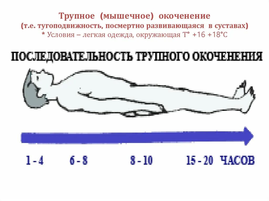 Трупное окоченение мышц. Трупное окоченение мышц
