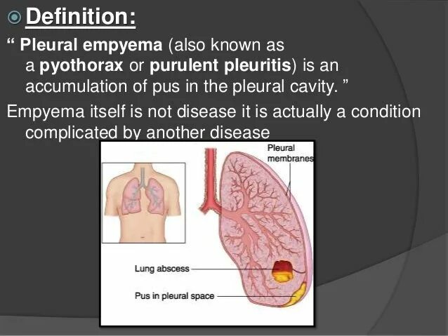 Эмпиема латынь. Drainage of the Pleural cavity in Pleural Empyema..